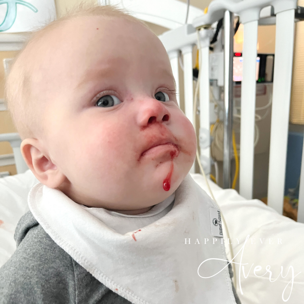 blood streaked baby face in pain and discomfort after transplant